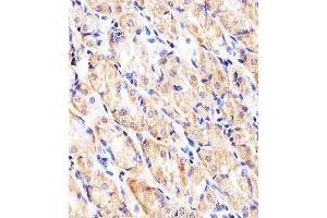 Immunohistochemical analysis of paraffin-embedded H. (Hexokinase 2 抗体  (AA 453-483))