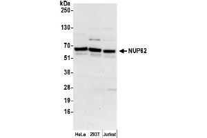 Western Blotting (WB) image for anti-Nucleoporin 62kDa (NUP62) (AA 472-522) antibody (ABIN7450510)