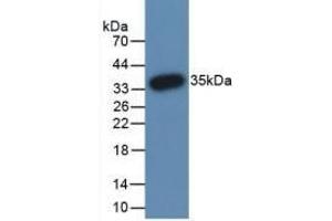 Detection of Recombinant PADI3, Human using Monoclonal Antibody to Peptidyl Arginine Deiminase Type III (PADI3)