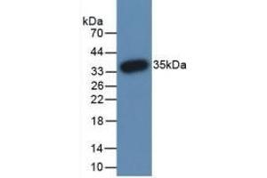 Detection of Recombinant PADI3, Human using Monoclonal Antibody to Peptidyl Arginine Deiminase Type III (PADI3) (PADI3 抗体  (AA 1-300))
