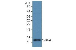 Detection of Recombinant S100B, Rat using Monoclonal Antibody to S100 Calcium Binding Protein B (S100B) (S100B 抗体  (AA 1-92))