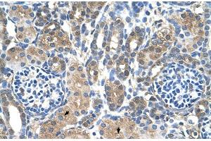 Human kidney (MTA2 抗体  (C-Term))