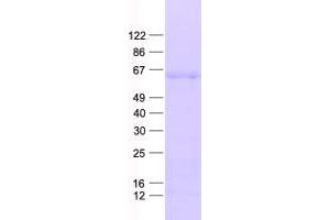 Validation with Western Blot (DEF8 Protein (His tag))