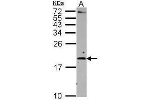 WB Image Sample (30 ug of whole cell lysate) A: Raji 15% SDS PAGE antibody diluted at 1:500 (IL-2 抗体)