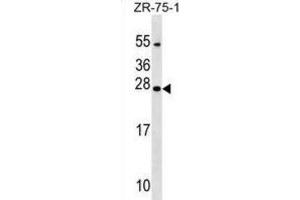 Western Blotting (WB) image for anti-Nucleoredoxin Like Protein 1 (NXNL1) antibody (ABIN2999692) (NXNL1 抗体)