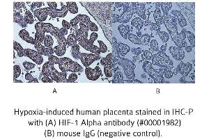 Image no. 7 for anti-Hypoxia Inducible Factor 1, alpha Subunit (Basic Helix-Loop-Helix Transcription Factor) (HIF1A) (AA 329-530) antibody (ABIN363210)