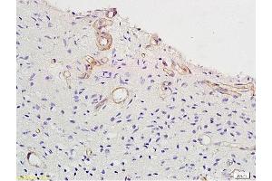 Immunohistochemistry (IHC) image for anti-Vitamin D Receptor (VDR) (AA 65-180) antibody (ABIN682513)