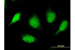 Immunofluorescence (IF) image for anti-SplA/ryanodine Receptor Domain and SOCS Box Containing 3 (SPSB3) (AA 1-355) antibody (ABIN530016)