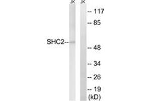 Western blot analysis of extracts from Jurkat cells, using SHC2 Antibody. (SHC2 抗体  (AA 261-310))