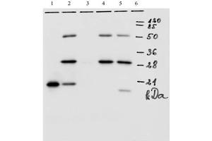 IP analysis of HPV-18 E7 protein. (HPV18 E7 抗体  (AA 1-35))