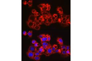 Immunofluorescence (IF) image for anti-Methyltransferase Like 7B (METTL7B) (AA 55-244) antibody (ABIN6143779)