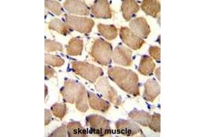 ARL17P1 Antibody (Center) immunohistochemistry analysis in formalin fixed and paraffin embedded human skeletal muscle followed by peroxidase conjugation of the secondary antibody and DAB staining. (ARL17A 抗体  (Middle Region))
