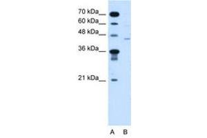 Image no. 1 for anti-Fukutin (FKTN) (AA 111-160) antibody (ABIN205072) (Fukutin 抗体  (AA 111-160))