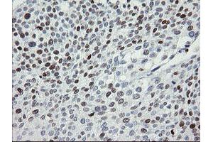Image no. 7 for anti-Transcription Factor MafB (MAFB) (AA 32-320) antibody (ABIN1491411)