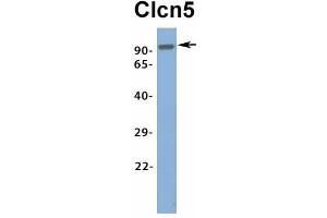 Host:  Rabbit  Target Name:  Clcn5  Sample Type:  Rat Brain  Antibody Dilution:  1. (Chloride Channel 5 抗体  (Middle Region))