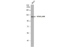WB Image NFkB p100 antibody [C2C3], C-term detects NFkB p100 protein by western blot analysis. (NFKB2 抗体  (C-Term))