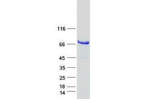 Western Blotting (WB) image for Glucosamine (UDP-N-Acetyl)-2-Epimerase/N-Acetylmannosamine Kinase (GNE) (Transcript Variant 2) protein (Myc-DYKDDDDK Tag) (ABIN2722101)