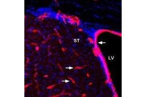 Immunohistochemistry (IHC) image for anti-Solute Carrier Family 2 (Facilitated Glucose Transporter), Member 1 (SLC2A1) (AA 468-481), (Intracellular) antibody (ABIN7043691)