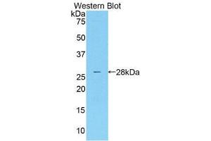 Western Blotting (WB) image for anti-Mannose Associated Serine Protease 2 (AA 445-683) antibody (ABIN1859763) (Mannose Associated Serine Protease 2 (AA 445-683) 抗体)