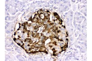 Anti- GLP1 Picoband antibody, IHC(P) IHC(P): Human Pancreatic Cancer Tissue (Glucagon 抗体  (N-Term))