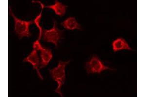 ABIN6272355 staining Hela by IF/ICC. (L1CAM 抗体  (C-Term))