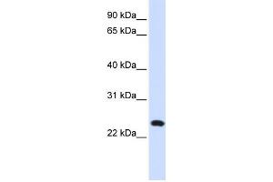 Western Blotting (WB) image for anti-Lysosomal-Associated Membrane Protein Family, Member 5 (LAMP5) antibody (ABIN2459056) (LAMP5 抗体)