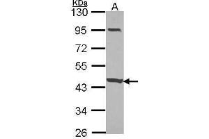WB Image Sample (30 ug of whole cell lysate) A: JurKat 10% SDS PAGE CCDC83 antibody antibody diluted at 1:1000 (CCDC83 抗体)