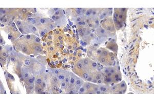 Immunohistochemistry (IHC) image for anti-Tumor Necrosis Factor Receptor Superfamily, Member 21 (TNFRSF21) (AA 406-605) antibody (ABIN7437356)