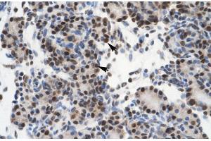 Rabbit Anti-GTF21 Antibody ,Paraffin Embedded Tissue: Human Pancreas  Cellular Data: Epithelial cells of pancreatic acinus  Antibody Concentration: 4. (GTF2I 抗体  (N-Term))
