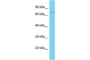 Host: Rabbit Target Name: CLEC4F Sample Type: Jurkat Whole Cell lysates Antibody Dilution: 1. (CLEC4F 抗体  (C-Term))