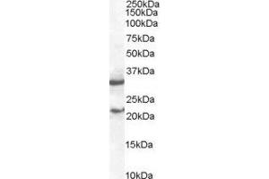 ABIN2560058 staining (2µg/ml) of mouse spleen lysate (RIPA buffer, 35µg total protein per lane). (SOCS1 抗体  (C-Term))