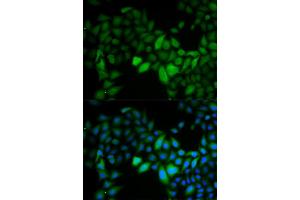 Immunofluorescence analysis of HeLa cells using TK1 antibody. (TK1 抗体)