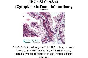 Image no. 2 for anti-Solute Carrier Family 39 (Zinc Transporter), Member 14 (SLC39A14) (Cytoplasmic Domain) antibody (ABIN1739369)