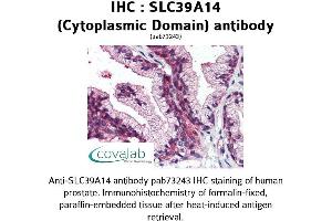 Image no. 2 for anti-Solute Carrier Family 39 (Zinc Transporter), Member 14 (SLC39A14) (Cytoplasmic Domain) antibody (ABIN1739369) (SLC39A14 抗体  (Cytoplasmic Domain))