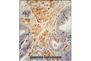 Immunohistochemistry (Paraffin-embedded Sections) (IHC (p)) image for anti-Follistatin-Like 1 (FSTL1) (AA 280-308), (C-Term) antibody (ABIN654491)