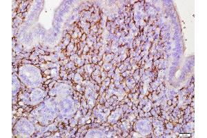 Immunohistochemistry (Paraffin-embedded Sections) (IHC (p)) image for anti-EGF, Latrophilin and Seven Transmembrane Domain Containing 1 (ELTD1) (AA 301-400) antibody (ABIN1713780)