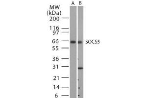 Image no. 1 for anti-Suppressor of Cytokine Signaling 5 (SOCS5) antibody (ABIN233231) (SOCS5 抗体)