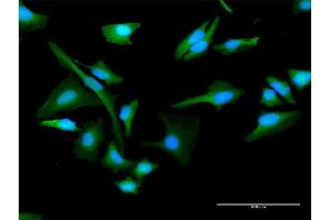 Immunofluorescence of purified MaxPab antibody to CHKA on HeLa cell. (Choline Kinase alpha 抗体  (AA 1-457))