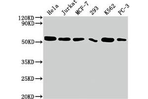 Western Blot Positive WB detected in: Hela whole cell lysate, Jurkat whole cell lysate, MCF-7 whole cell lysate, 293 whole cell lysate, K562 whole cell lysate, PC-3 whole cell lysate All lanes: CDC37 antibody at 1:2000 Secondary Goat polyclonal to rabbit IgG at 1/50000 dilution Predicted band size: 45 kDa Observed band size: 50 kDa (Recombinant CDC37 抗体)