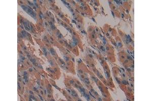 Immunohistochemistry (IHC) image for anti-ATP-Binding Cassette, Sub-Family A (ABC1), Member 9 (ABCA9) (AA 1422-1589) antibody (ABIN5013178)