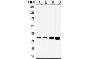Western blot analysis of HOXD8 expression in A375 (A), A431 (B), HepG2 (C), HeLa (D) whole cell lysates. (HOXD8 抗体  (C-Term))