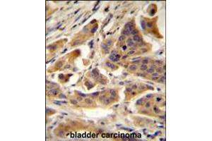 Immunohistochemistry (IHC) image for anti-RanBP-Type and C3HC4-Type Zinc Finger Containing 1 (RBCK1) (AA 16-46), (N-Term) antibody (ABIN5534668)