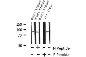 Western blot analysis of Phospho-Catenin beta (Tyr489)expression in various lysates (CTNNB1 抗体  (pTyr489))