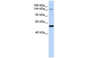 EDC4 antibody used at 1 ug/ml to detect target protein. (EDC4 抗体  (N-Term))