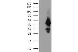 Image no. 2 for anti-Ubiquitin-Conjugating Enzyme E2, J1, U (UBE2J1) antibody (ABIN1501637) (UBE2J1 抗体)