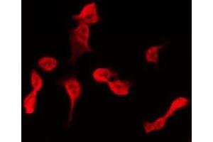 ABIN6275399 staining Hela by IF/ICC. (APOBEC3B 抗体  (N-Term))