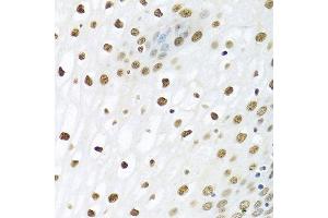 Immunohistochemistry of paraffin-embedded human esophagus using PTBP1 antibody. (PTBP1 抗体  (AA 1-100))