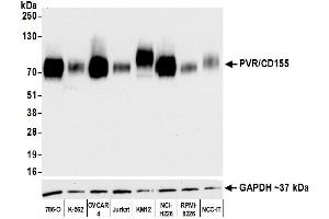 Western Blotting (WB) image for anti-Poliovirus Receptor (PVR) (AA 28-329) antibody (ABIN7449549)