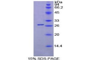 SDS-PAGE analysis of Mouse Lipase, Pancreatic Protein. (Lipase 蛋白)