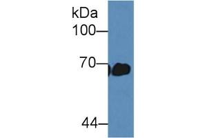 Detection of ALB in Mouse Serum using Polyclonal Antibody to Albumin (ALB) (Albumin 抗体)